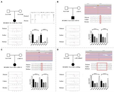 High-Frequency Exon Deletion of DNA Cross-Link Repair 1C Accounting for Severe Combined Immunodeficiency May Be Missed by Whole-Exome Sequencing